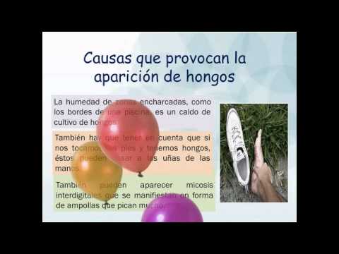 La desaparición del dedo al hongo de la uña
