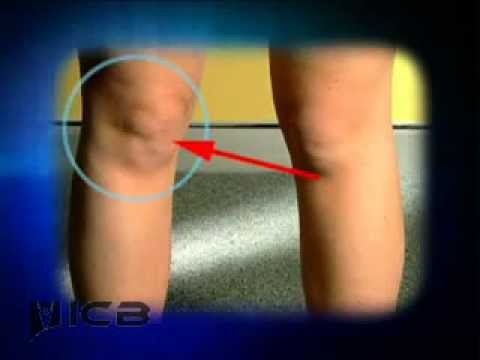 pain on outside of knee