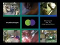 Fécondation in vitro a lyon