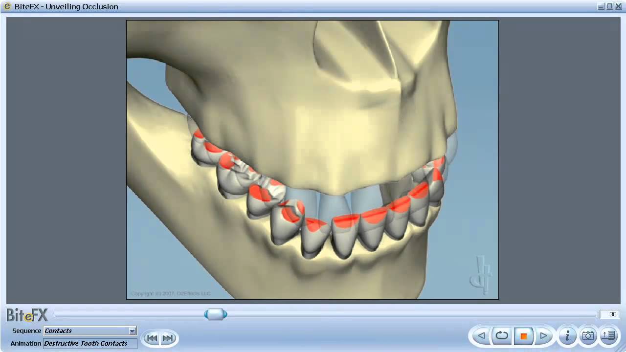 Dissertation dental occlusion