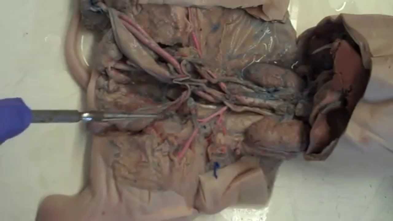 Fetal Pig Dissection: 5.1 Ventral View of Urogenital System of a Male