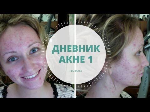 Тяжесть на лице днем Тяжесть на лице днем