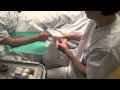 Pose d'un cathéter veineux périphérique (VVP)