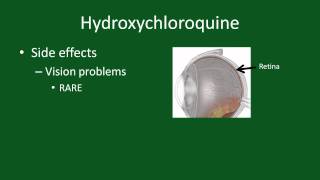 YouTube Video: Hydroxychloroquine for Rheumatoid Arthritis