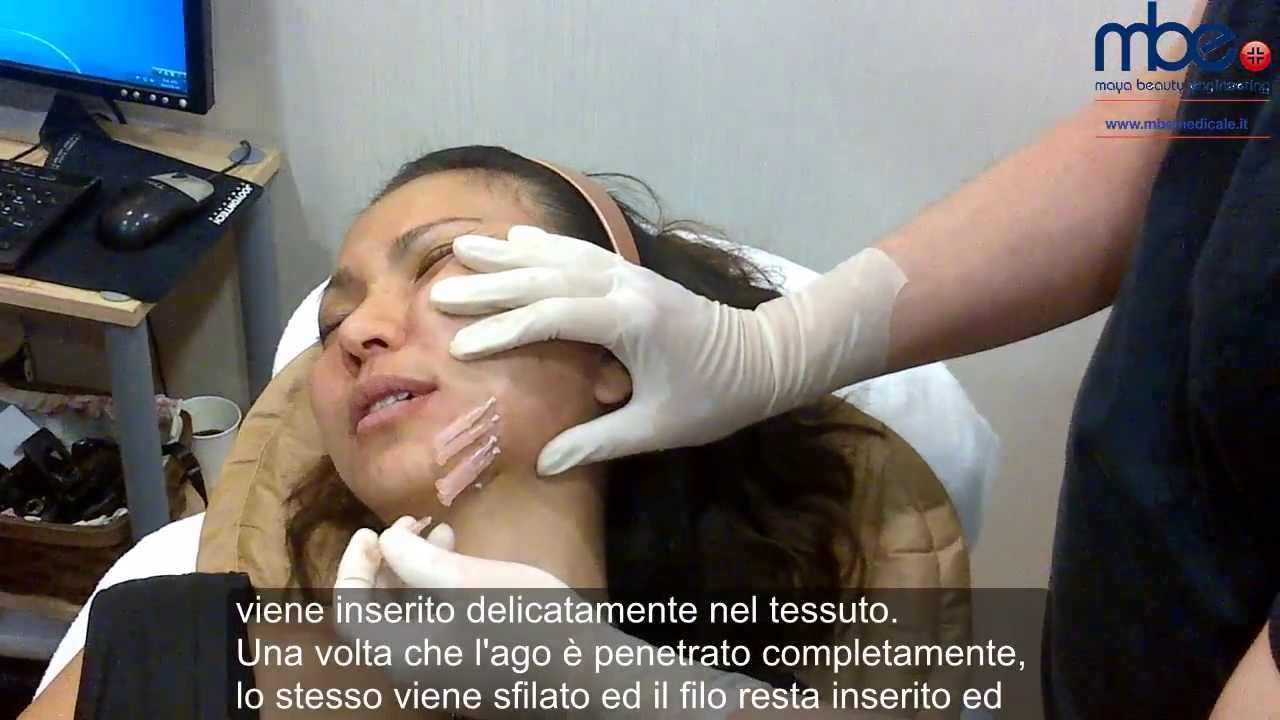 Emorroidi interne di una fotografia dopo la consegna