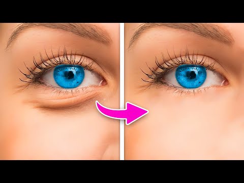 HOW TO: MAKE UNDER EYE BAGS DISAPPEAR IN SECONDS!!!! - YouTube