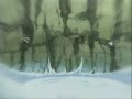 AMV - Naruto vs Sasuke - by Leinad