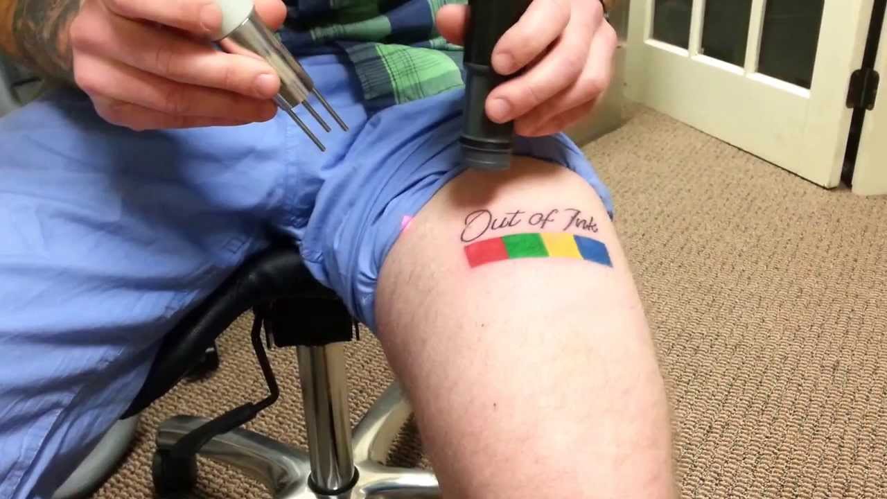 laser tattoo removal in plymouth amp south shore ma youtube laser tattoo removal in plymouth amp south shore ma youtube