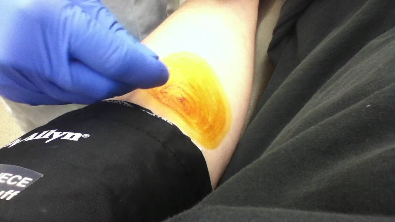 plasma donating