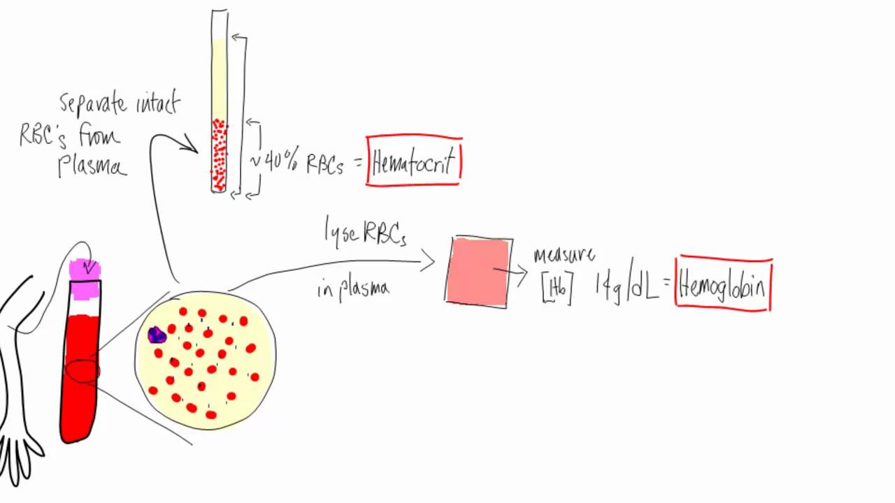 Anemia Basic lab tests hematocrit, hemoglobin, reticulocyte, MCV