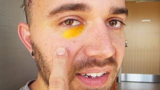 DOES THIS LOOK INFECTED?! (9.22.13 - Day 1606)