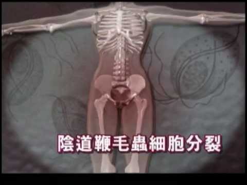 9. 陰道鞭毛蟲 - YouTube pic