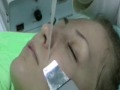 Ввод коллагена (импульсный микромассаж) Ввод коллагена (импульсный микромассаж)