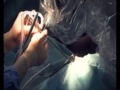 ROSA, fine tuning Neurosurgery excellence, (France Ô channel, january 2013).mp4