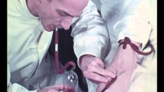 la transfusion de sang conservé de 1938
