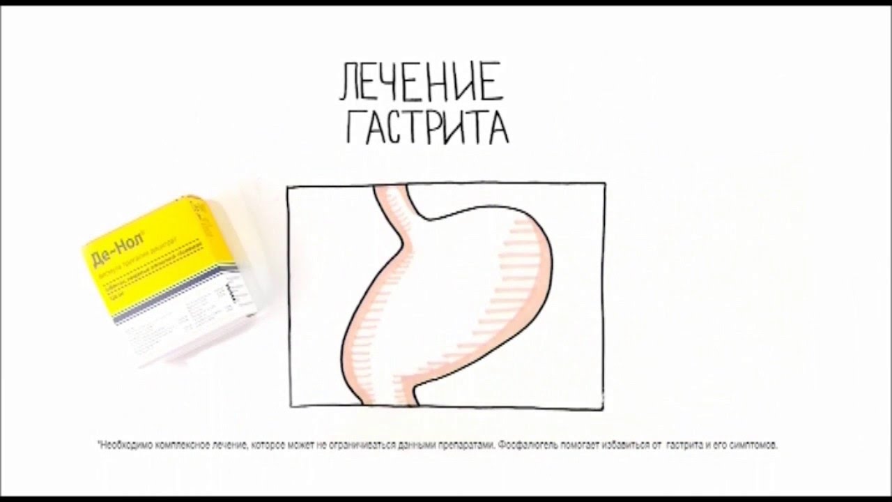 Видео: лечение гастрита 3 перекисью Видео: лечение гастрита 3 перекисью
