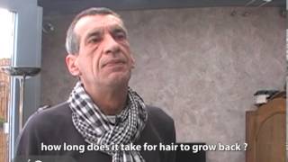 Testimony of Mr Jean-Noël Michaux on stopping his baldness with Géomer