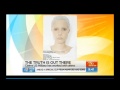 Dr Charles Hall on Sunrise - Contact with tall white ET's