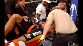 Anderson Silva fratura a canela/breaks leg - 29/12/2013 Br - By M2U