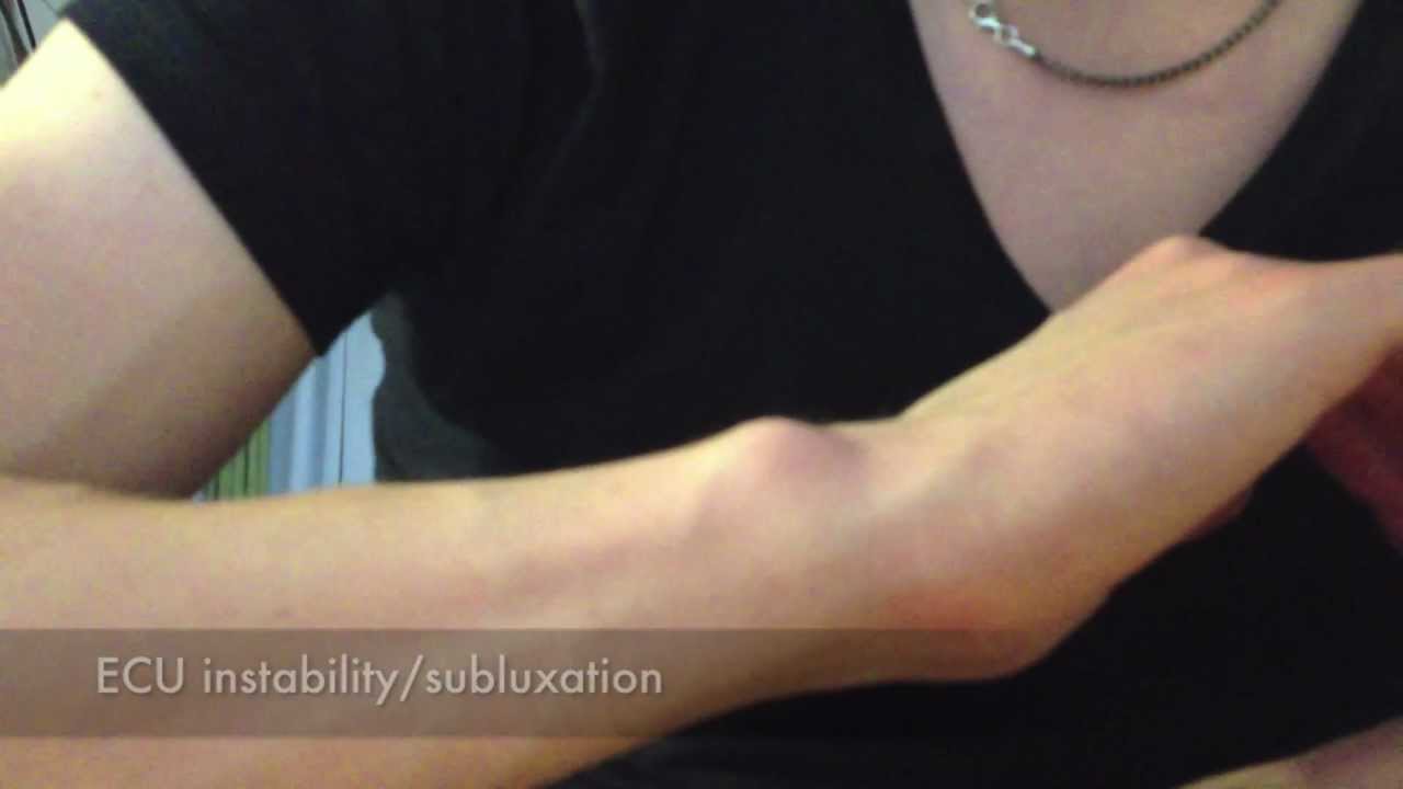 ECU instability and subluxation - YouTube