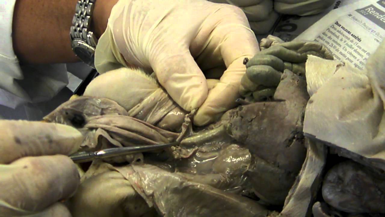 A&P - Female reproductive system on a fetal pig - YouTube