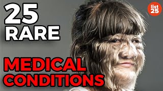 25 Rare Medical Conditions You Never Heard Of