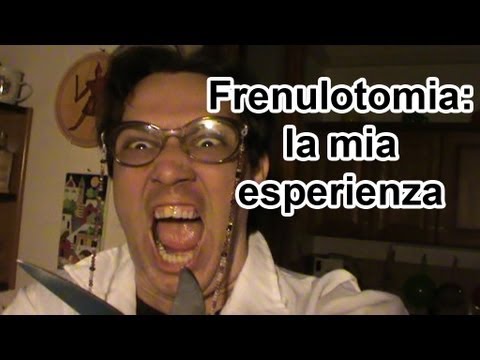 Chi poteva aumentare il membro