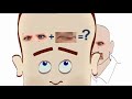 Autism?