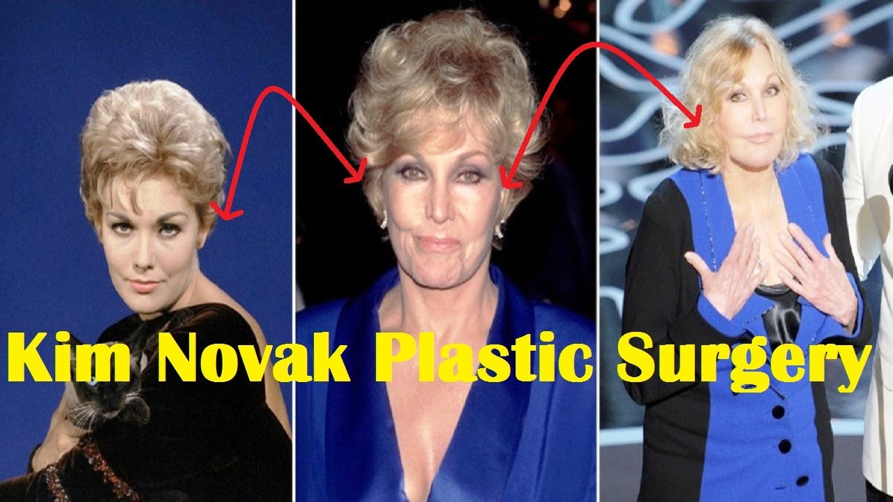 Kim Novak Plastic Surgery Before and After YouTube