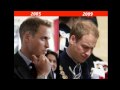 Prince William's Beauty [before - After] Kate In Pictures 