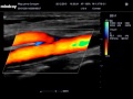 Нажмите для просмотра : Миндрей DC 7. Некоторые возможности-2