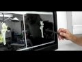 Joeys Surgery Plan.wmv