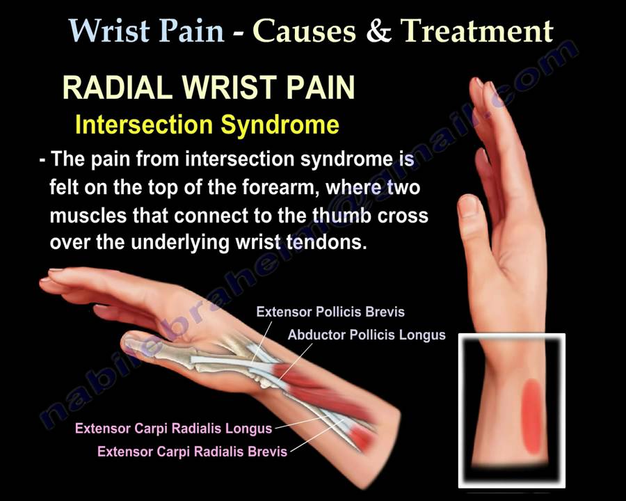 Wrist Pain,causes and treatment,Part 2 - Everything You Need To Know