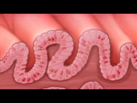 What is Barretts Esophagus?-Mayo Clinic - YouTube