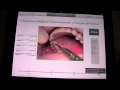 Démo iMuco Récessions gingivales app iPad
