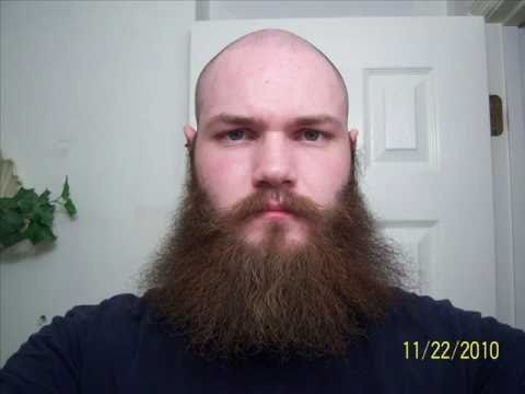 Um ano de barba sempre a crescer Um ano de barba sempre a crescer