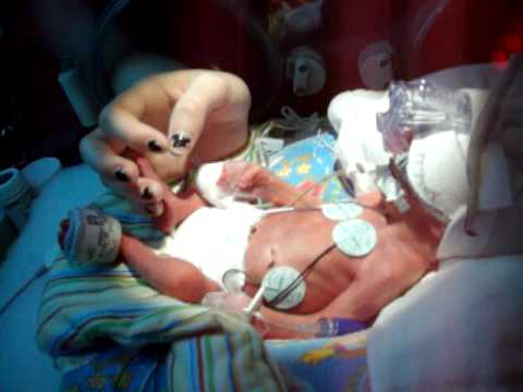 Rozthorne 2 pound Preemie baby born at 28 weeks - YouTube
