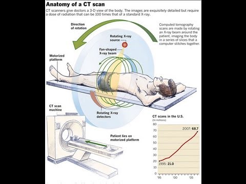How CT Scan Machine Works - YouTube