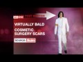 Leaked Out Autopsy Of Michael Jackson - Youtube