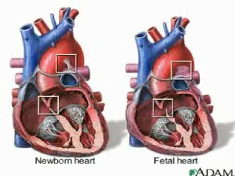 fetal heart circulation - YouTube