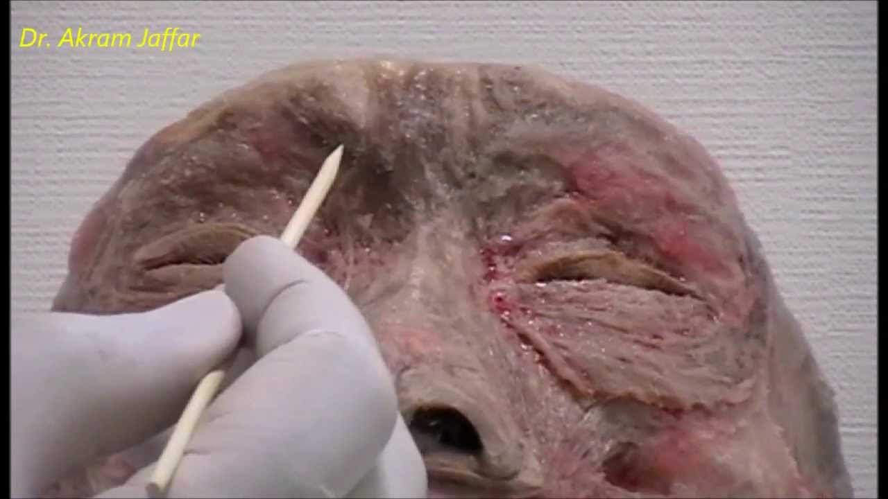 Essential anatomy for facial Botox injections, abridged version - YouTube
