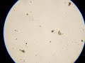 Lake Water Organism - Rotifer (Microscope)