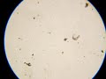 Lake Water Organism - Rotifer (Microscope)