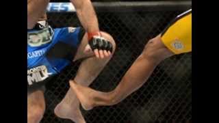 REVANCHE  ANDERSON SILVA  28/12/2013- ANDERSON SILVA PERDE A REVANCHE  FRATURA A PERNA