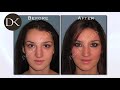 Breast Augmentation with Silicone and Revision Rhinoplasty