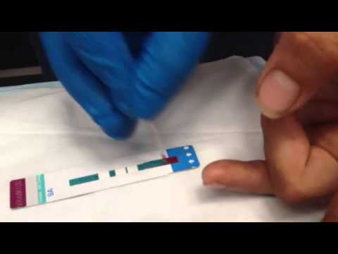 Dave takes HIV Rapid Test