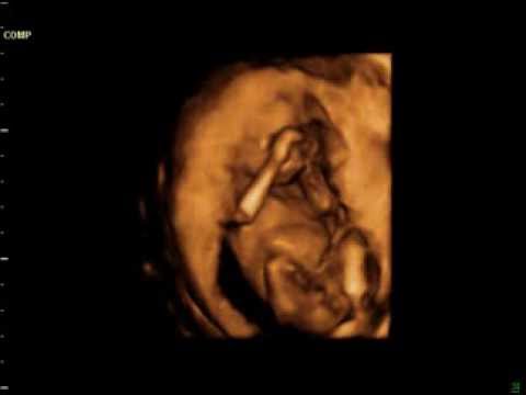 4d ultrasound video at 10 weeks