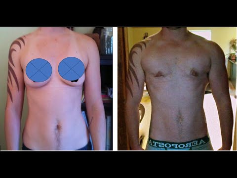 Low testosterone treatment results