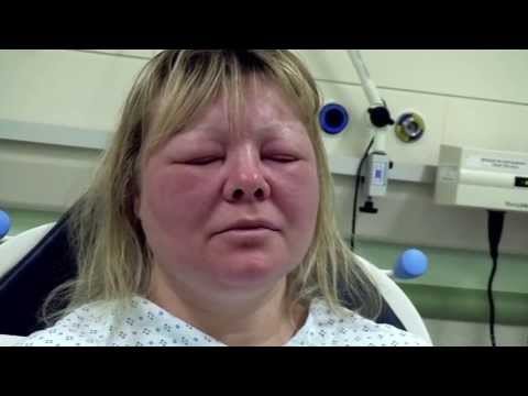 Allergic Reaction On Face Cosmetics Allergic to latex - bizarre er