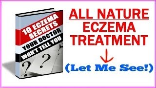 Eczema Treatment - How To Get Rid Of Eczema Naturally?